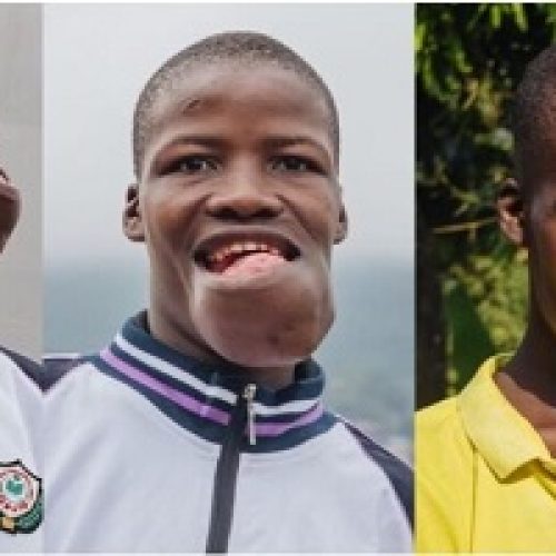 MAN RECEIVES LIFE-SAVING SURGERY TO REMOVE MASSIVE JAW TUMOR